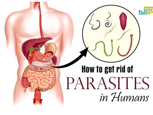 Top 8 Foods That Kill Parasites